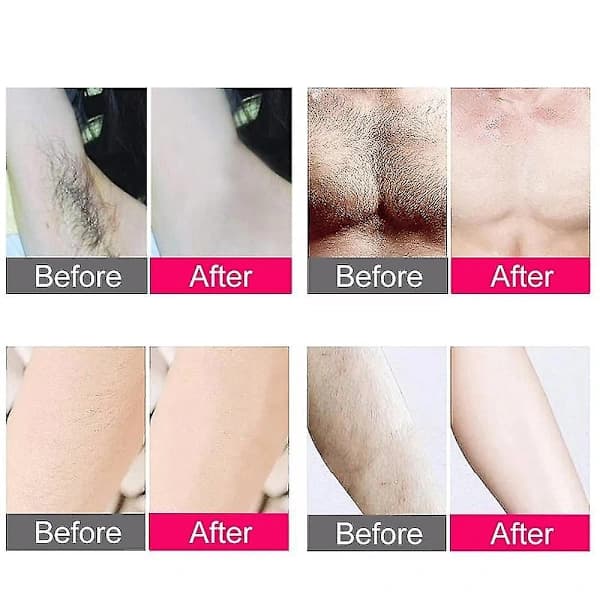 Laserhårfjerning Epilator 300000 Blink Rakning Og Hårfjerning Permanent Epilator Hvit