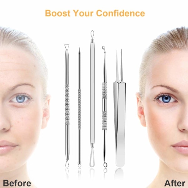 /HH/ Blackhead Remover Kit med 10 deler Rustfritt stål