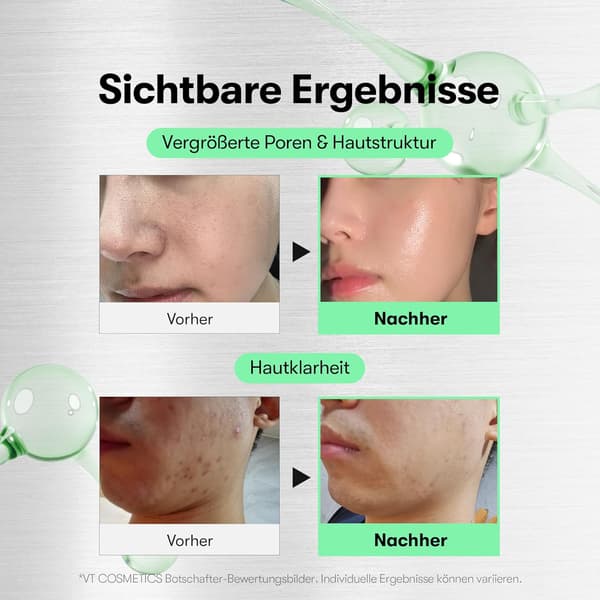 Serum til porepleje og eksfoliering, indeholder Centella Asiatica-ekstrakt.