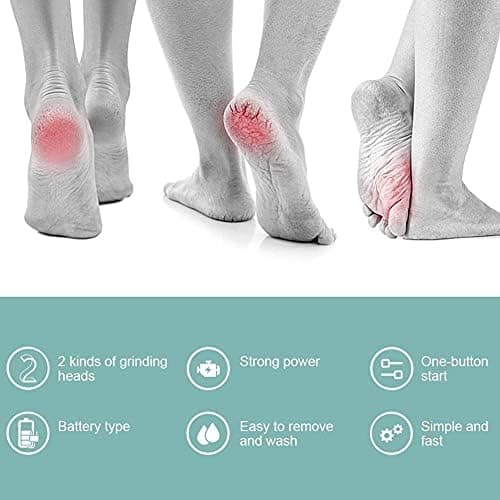 【YD】Electric Foot File for Calluses, Battery-Powered Foot File