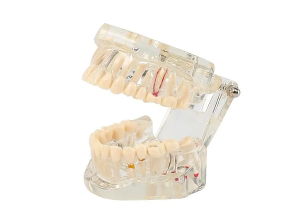 Dentalmodell käke med 14 uttagbara tänder 10x7,5x6,5 cm
