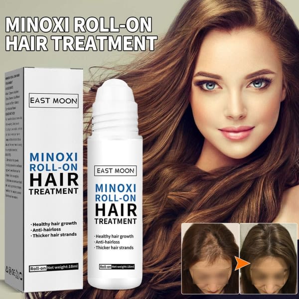 TG 1/2/3PCS Re:act Minoxi Roll-on Hårbehandling, 2023 Nytt Hårvekst Multi-colorA 18ml