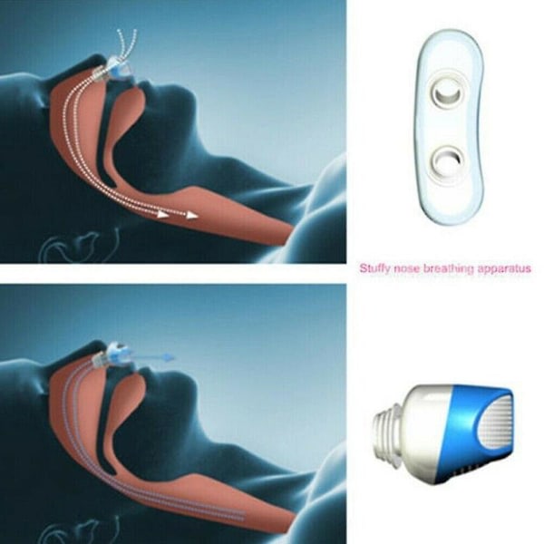 TG Micro Cpap Anti Snoring Elektronisk enhed for sömnapné Stoppa Snarkhjälp Stopper Hjælpemiddel Stoppare Luftrenare Filter rød