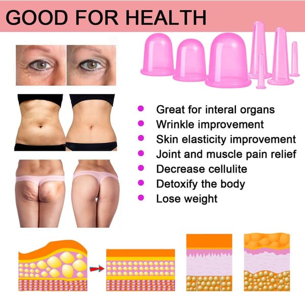 Cellulite Kopper - Cupping mod Cellulite - Premium Kvalitets Cupping Sæt (7 Dele) - Cupping Kopper - Hele Kroppen - Cupping Kopper Massage