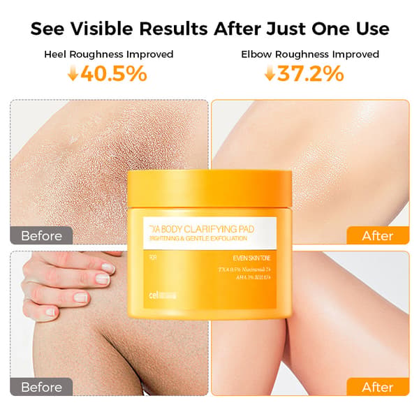TXA Body Clarifying Pad (Tranexamsyre Kropsoplysende Rensende Pad) 1pcs