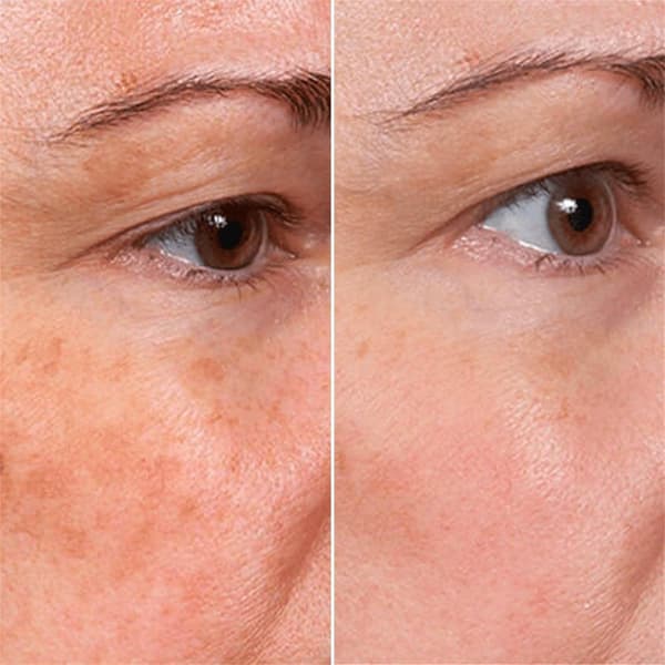 Inblair Rejuvenate Resurfacing Ansiktsserum