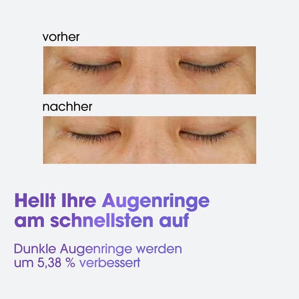 SOME BY MI Retinol Triple Action Øjencreme: Anti-aging, reducerer fine linjer