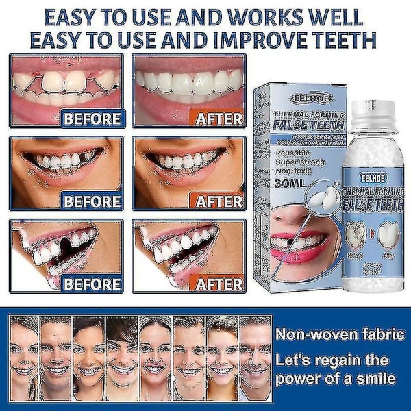 Vedenpitävä hammasliima Hammaslääkäri hampaiden täyttöaukkojen täyttöpakkaus Vedenpitävä ja turvallinen hampaiden viilujen aukkojen korjaus hampaat