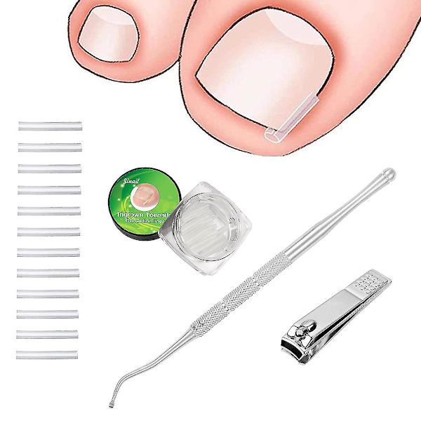 50-pack Ingrodda Naglar Pad Inbäddade Tånagel Korrigeringsdynor Nagel Artefakter Ortopedisk Man Kvinna Professionell Fotvård Verktyg
