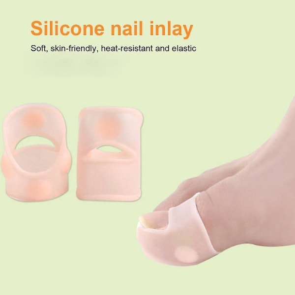 2st/ set Inåtväxande tånagelkorrigering fingernagel tå Nagelvård Inåtväxande nagelspår klistermärken