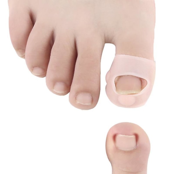 2st/ set Inåtväxande tånagelkorrigering fingernagel tå Nagelvård Inåtväxande nagelspår klistermärken
