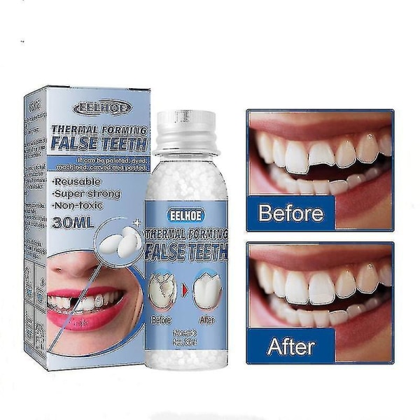 Vandtætte tænder Lim Tandlæge Tandfyldning Hulfyld Fix Kit Vandtæt og sikker tandfiner Huller Reparationstænder