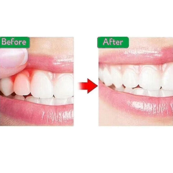 Instant Dental Spray lievittää hammaskipua (FMY)