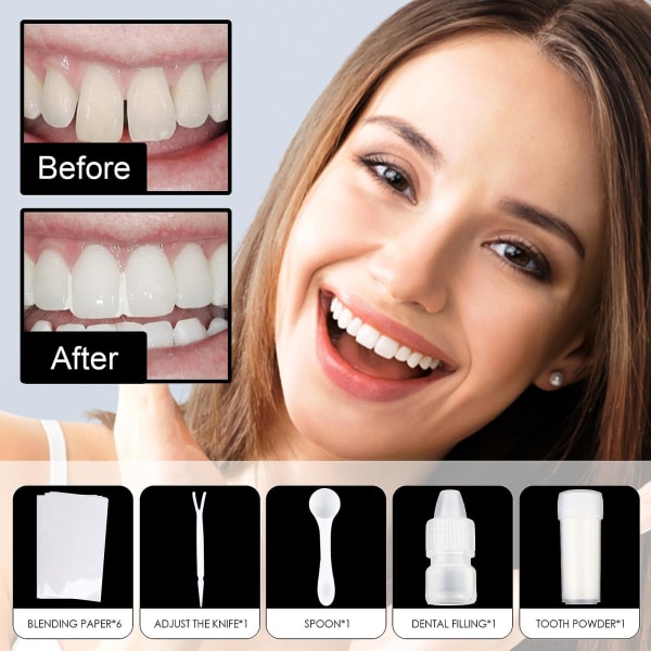 Tandfyldningssæt Tandfyldningsreparationssæt Midlertidig tandreparation Cementtændergab Falsetænder fast limsæt (FMY)