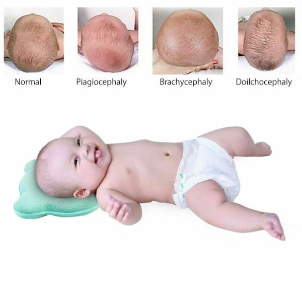 Baby Stereotyp Kudde Memory Foam Kudde Nyfödd Spädbarn Skydd Huvudform Sovkudde Resekudde för 0-24 månader yellow