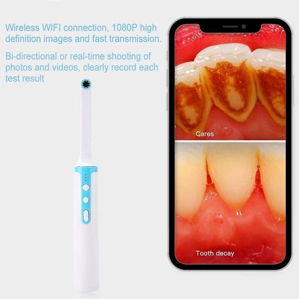 Wifi Smart Dental Camera 1080p 2mp Hd Dental Intraoral Camera 8leds Lättvikt Tandläkare Inspektionskamera Ip67 Vattentät/360 Endoskop/realtids Vide