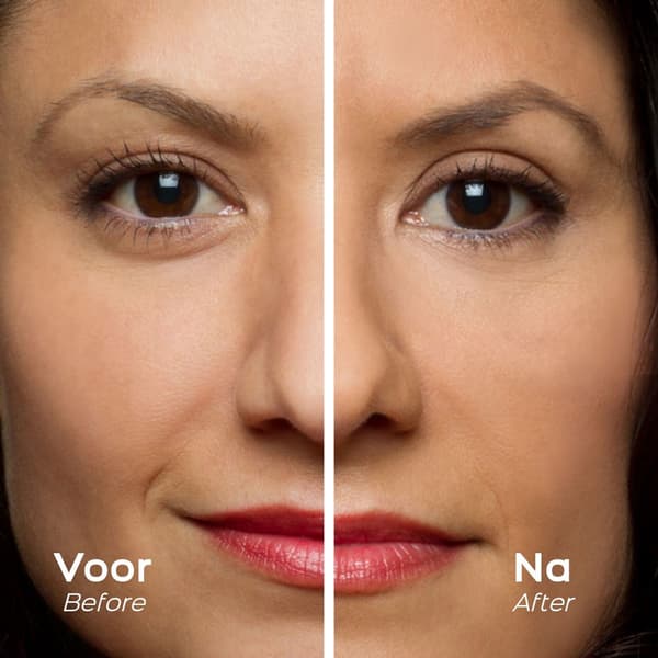 Orange Care Easylift - Øjenlågstape