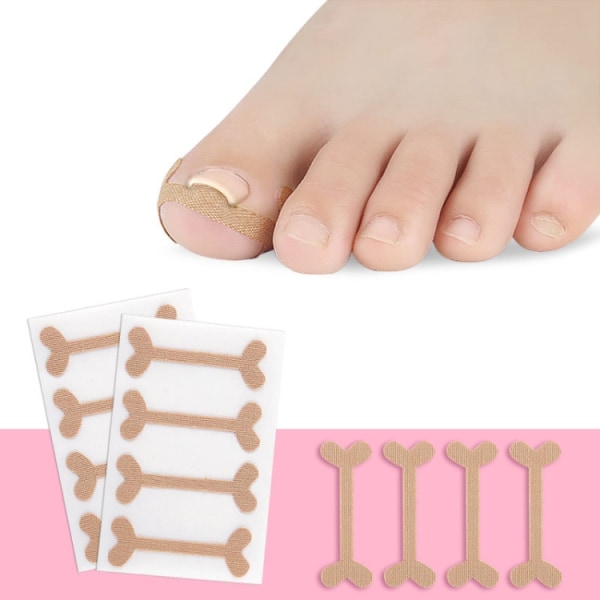 Nageltrångsplåster på tån