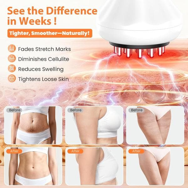 4-i-1 Lymfedrænage Massager - Dybdegående Massage til Krop & Cellulite