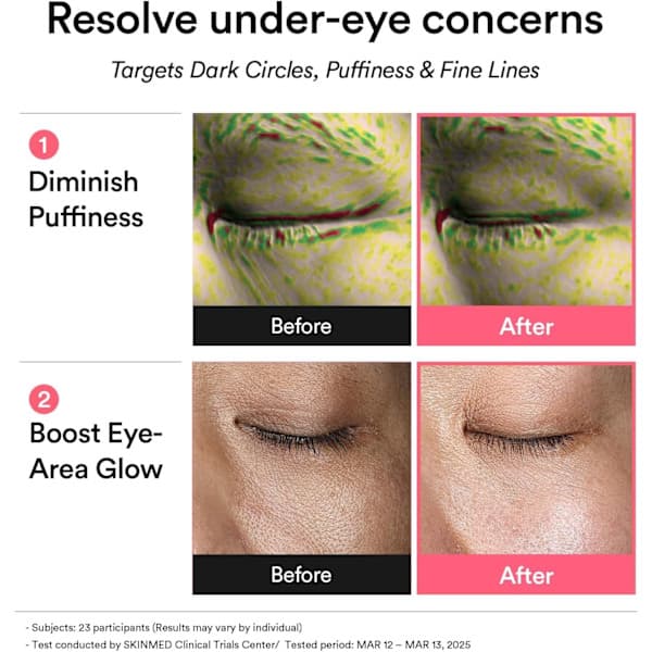 Abib PDRN Retinal Eye Patch (Glow Jelly) hjelper til med å lindre hevelser og mørke ringer under øynene.