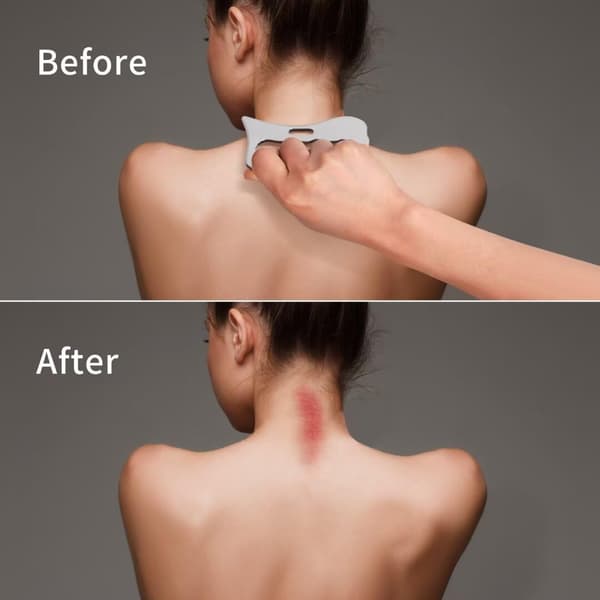 1 stk. Gua Sha massageværktøj, skraber i rustfrit stål til forbedring af blødt væv, fysioterapiudstyr, bruges til