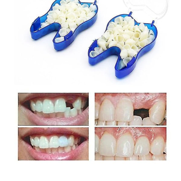 Midlertidige tandproteser tilstopper øvre tandproteser, finerproteser, manglende tænder, knækkede tænder og huller mellem tænderne