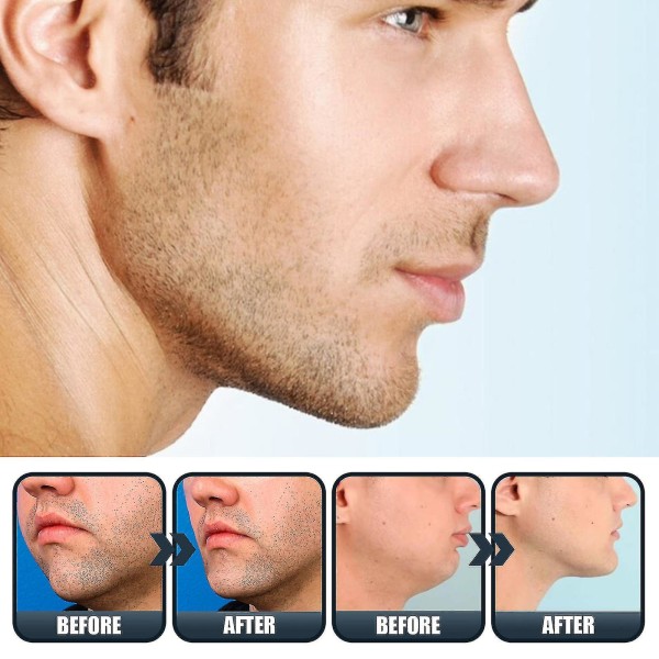 East Moon Tynd Jawbone Essence Fastgørende Ansigtshud Vis Jawbone Nedre Jaw Line V Face Essence