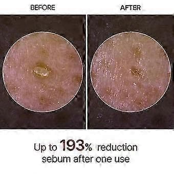 2 STK Dr.Melaxin PEEL SHOT GLOW EXFOLIANT RICE AMPOULE (HVIT RIS/SVART RIS)