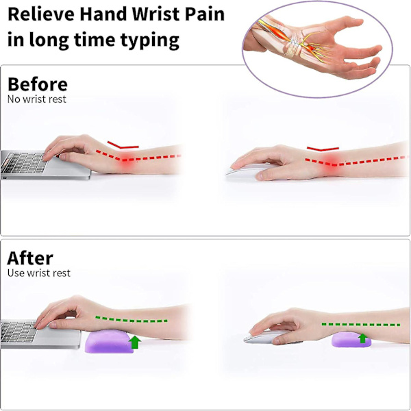 Handledsstöd Set, Tangentbordshandledsstöd Matta, Ergonomiskt Musstöd Kudde Pad Bekväm & Anti-halk & Smärtlindring Datorhandledsstöd