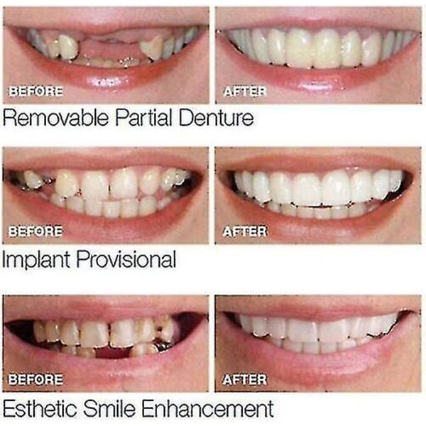 Smile snapp på falske tenner Øvre nedre tannfiner tannproteser tanndekselsett