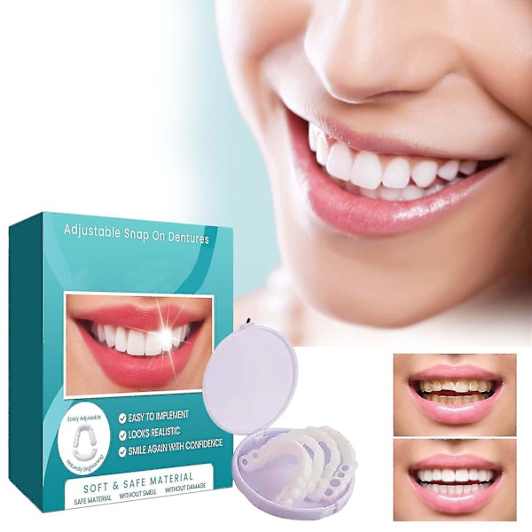 Justerbara Snap-on Proteser, Veneer Proteser Tandställning Plus Proteser Fodral, Tillfälliga Fyllningar Tandställning Interdental Fyllningar Rätande Proteser Kit
