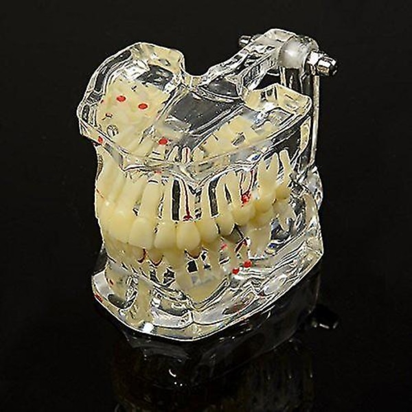 1 stk. Voksenpatologier Demonstration Model Dental Study Model