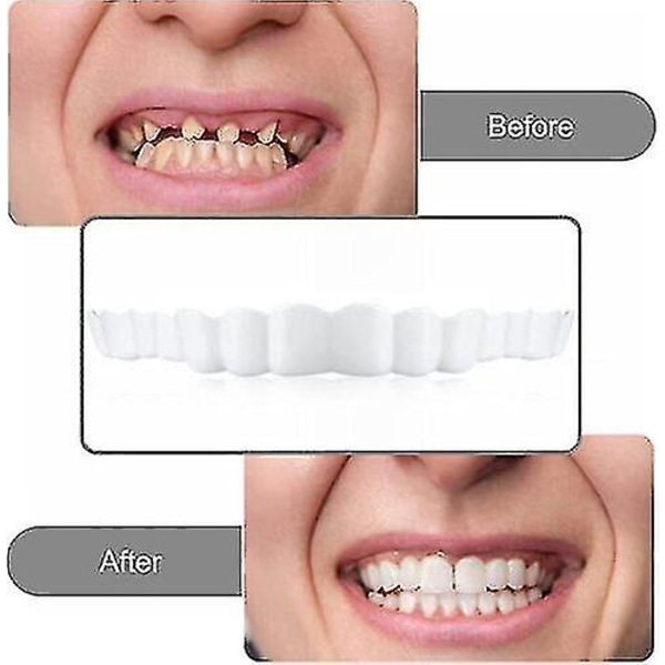 Smile Knäpp på falska tänder Övre nedre tandfasader Tandproteser Cover Set