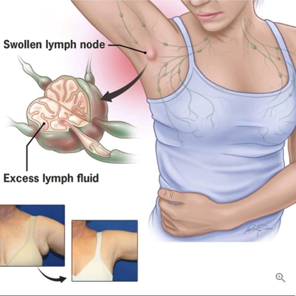 4-pak Lymfedrænage Terapi Magnetiske Ringe, Justerbar Lymfedrænage Ring Terapi Magnetiske Ringe, Unisex