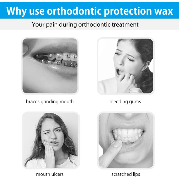 10Box Hammasvaha olkaimet, silikoninen ortodonttivaha hedelmätuoksuinen vaha hampaita käyttäjille, ikenet suojaavat suun hoitoa