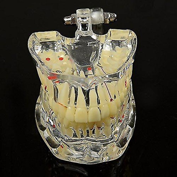 1 stk. Voksenpatologier Demonstration Model Dental Study Model