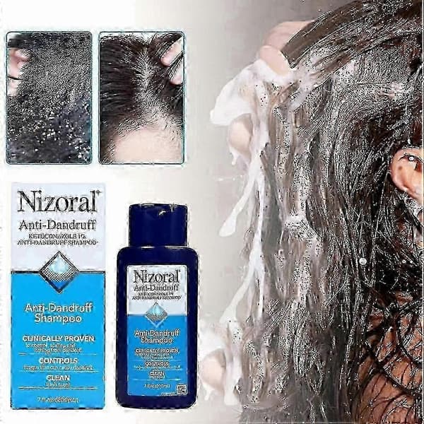 nizoral 7 fl oz 200ml hilse shampoo 2025