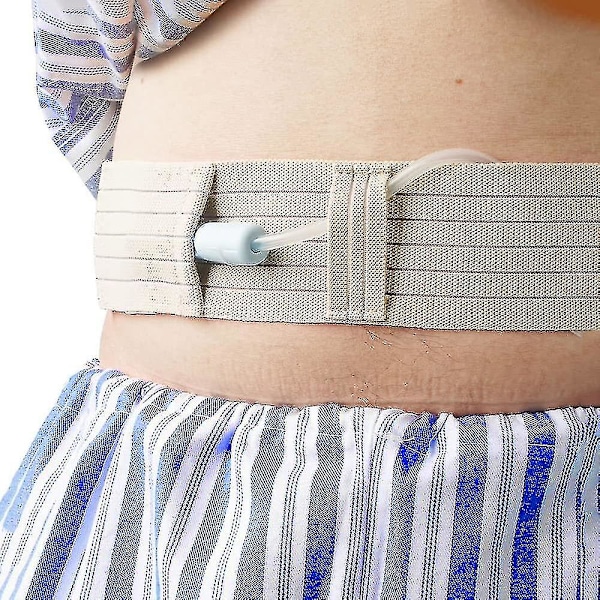 (2 st, L) Peritonealdialyskateterbälte - G-rörhållare för män och kvinnor - Abdominalt dialysbälte för PD, G, PEG, J-rör fixerat - Dialystillbehör