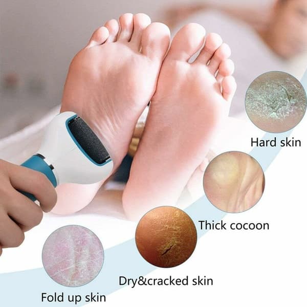 Fotvård Fotvårdsslipning Exfoliering Anti-förhårdnader