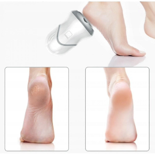 Rechargeable Electric Foot Grinder For Vacuuming And Removing Calluses