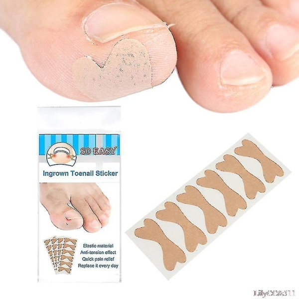 Nail Correction Patch Ingredient Toenail Correction Patch Paronychia Treatment