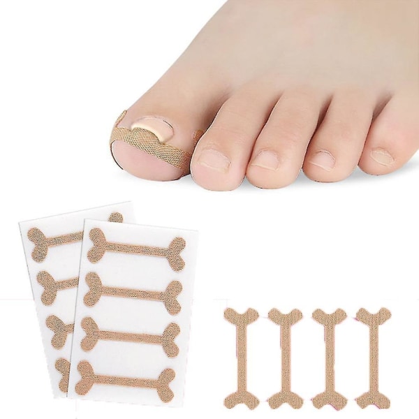 4 Pack Toe Nail Groove Foot Nail Orthodontic Device Thumb Nail Patch Quick Pedicure Toe Nail Deforma