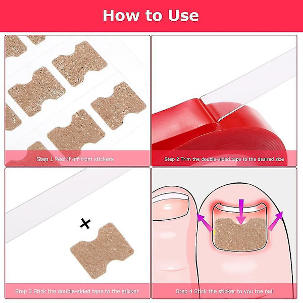 30pcs Ingrown Toenail Correction Patch Breathable Elastic Cotton Glue Patch Thumb Bent Toenail Clip Pedicure Tool