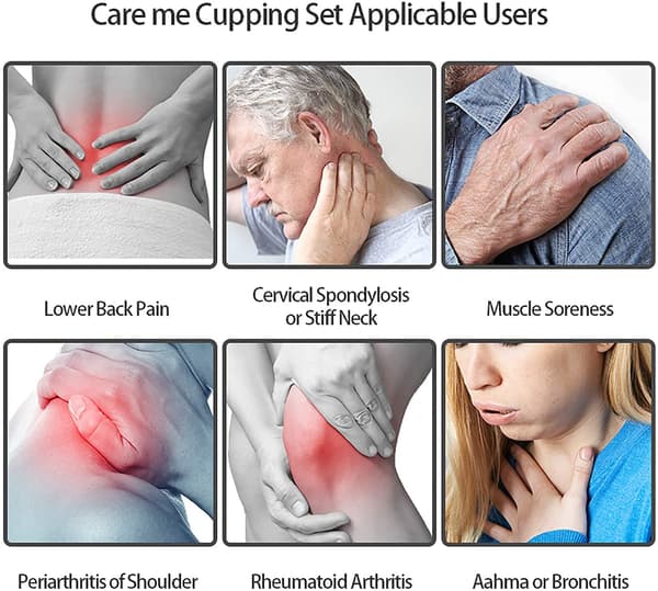 Cupping med vakuumpumpe til behandling og massage 12 stk