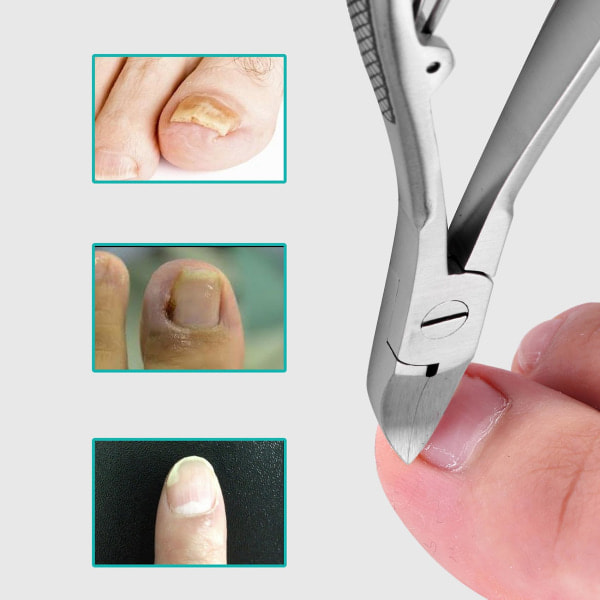 Professionelle Fødder Tånegl Klippere Trimmer Paronychia Nipper Fodpleje Rustfrit Stål Værktøj Sølv