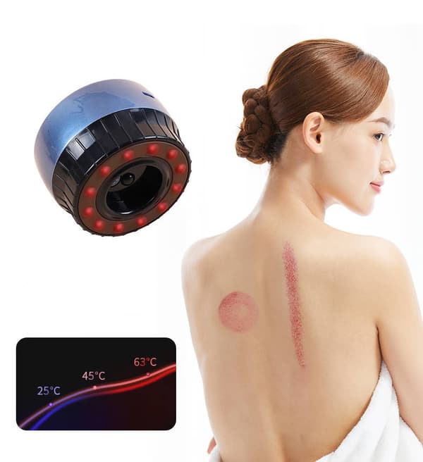 Elektronisk massageapparat til cupping-terapi - genopladeligt Svart