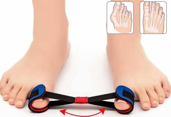 Hallux Valgus - Tåkorrektionssæt 9 dele