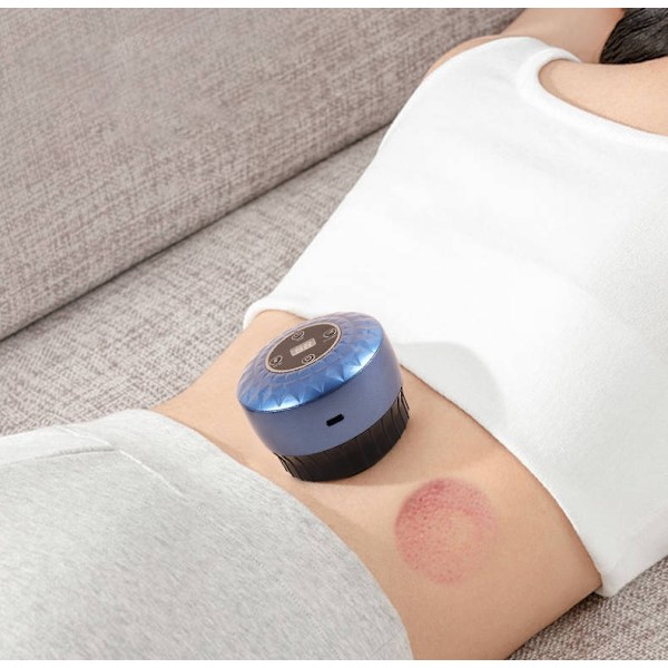 Elektronisk Massageapparat för Koppningsterapi - Laddningsbar Svart