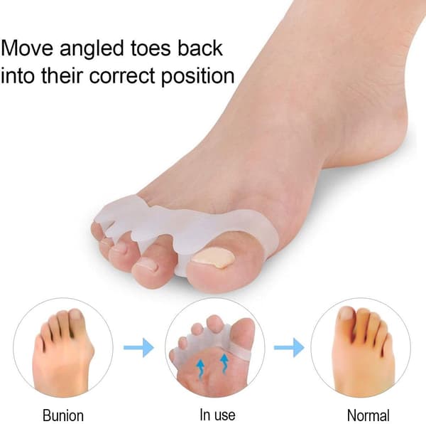Hallux valgus korrigerer 1 par, hvid