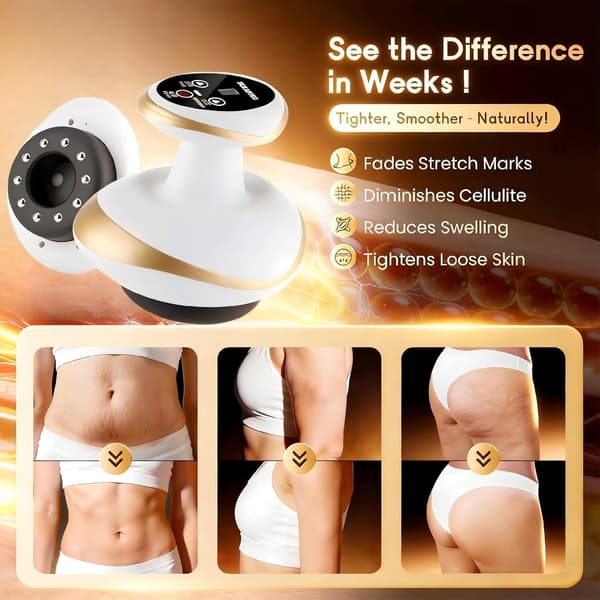 4-i-1 Anti-Cellulit Massager: Gua Sha, Elektrisk Koppning, Meridianrengöring och Värmeterapi Massage